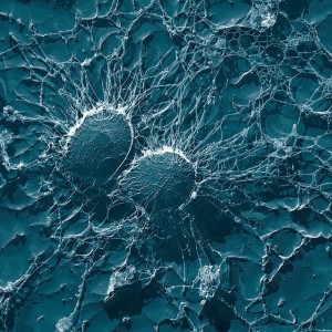 Staphylococcus aureus – sekundärelektronenmikroskopische Aufnahme. (© Eric Erbe, Christopher Pooley - U. S. Department of Agriculture)