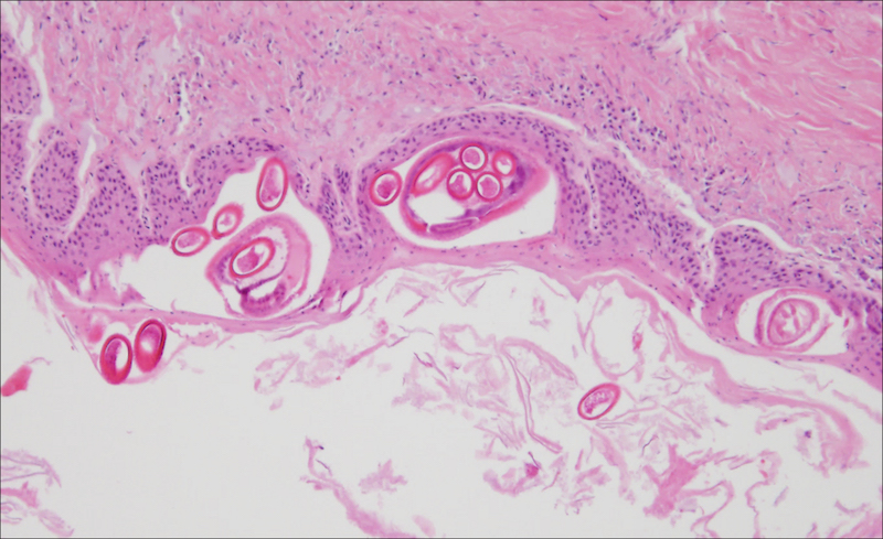 Nematodeneier im Analbeutel eines Fuchses